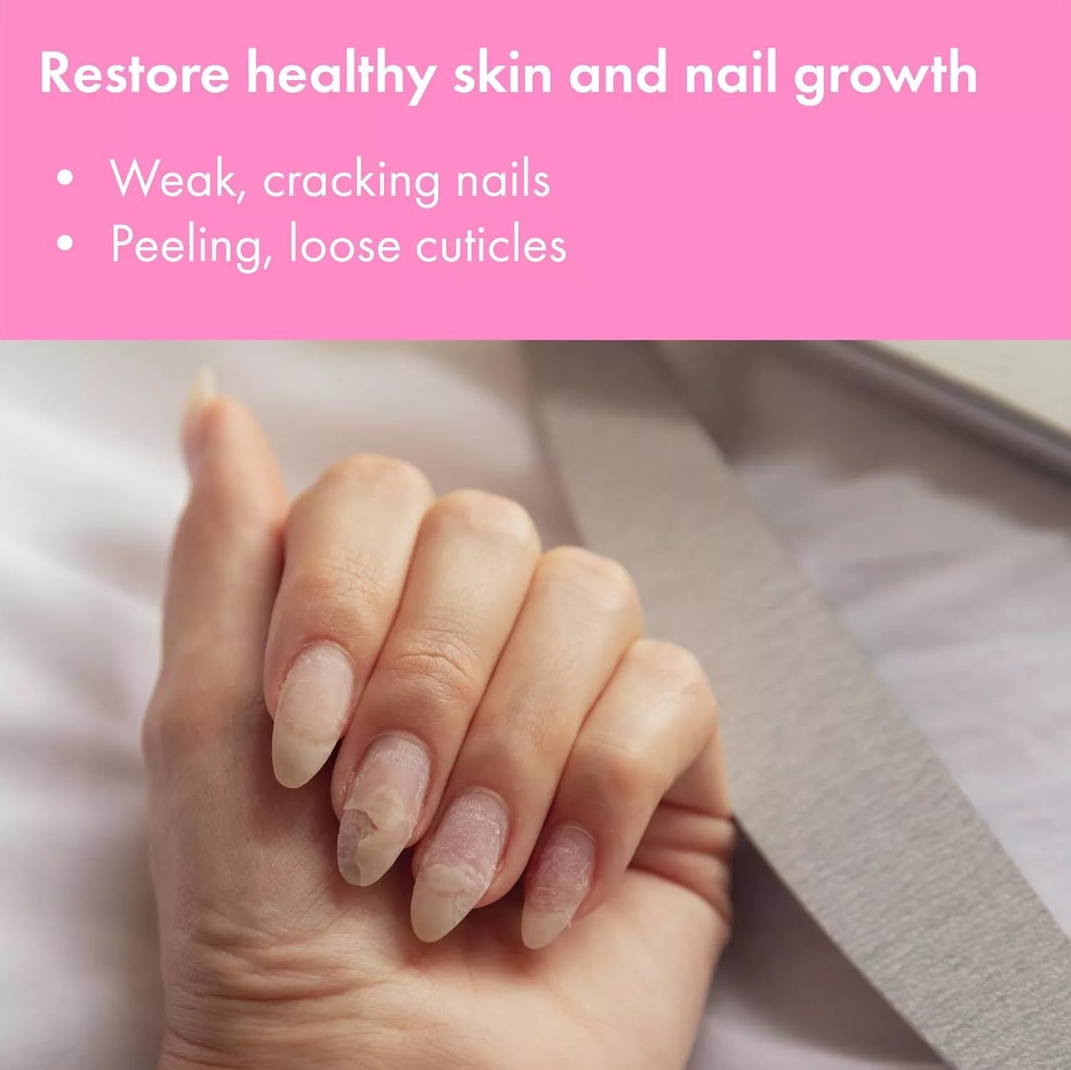 Vite20 Nail Clearing Gel, 0.50 oz