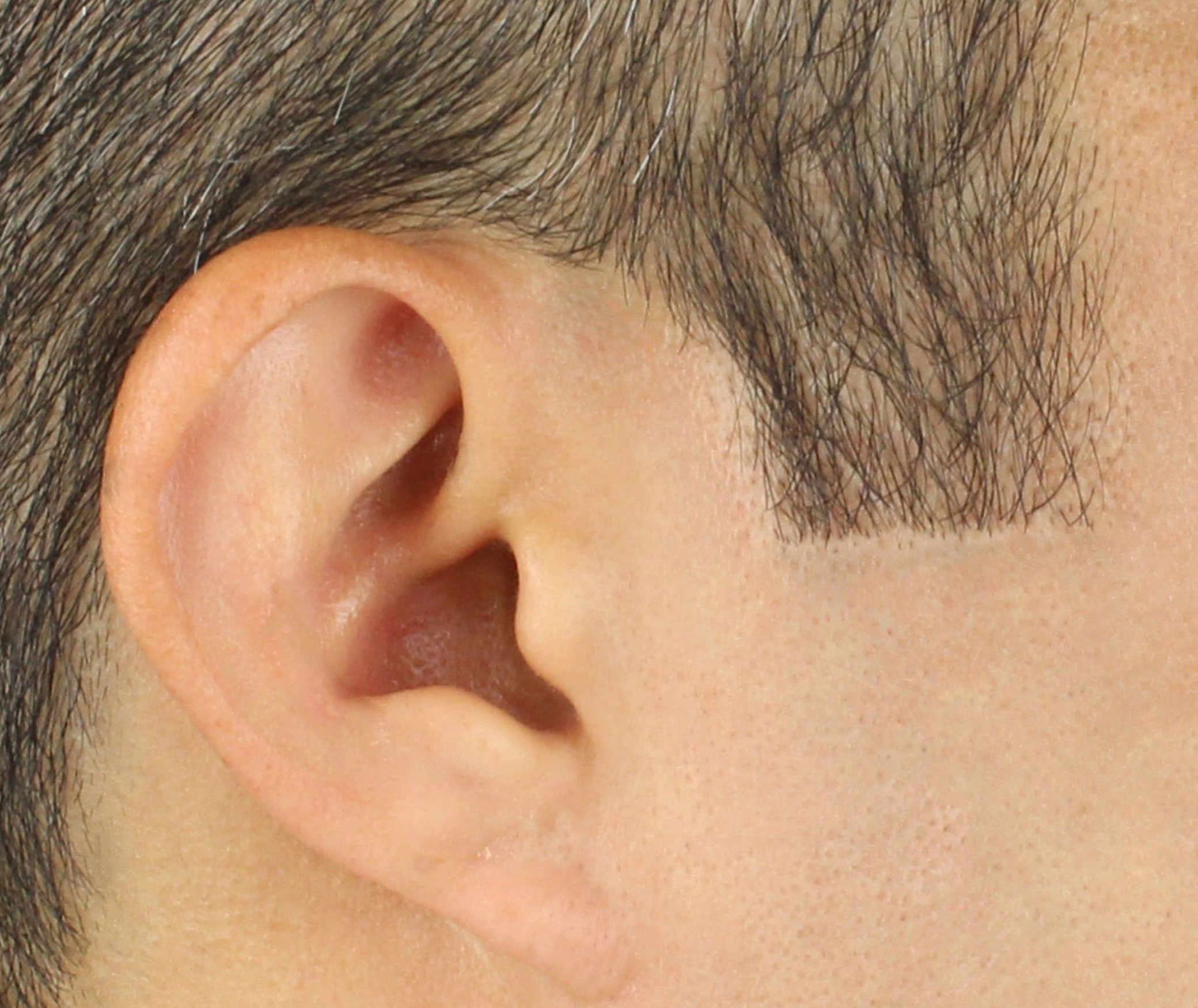 Man Side Hair